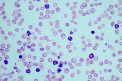 19/10/2022 Granulocitos en muestras sanguíneas de ratones con leucemia mielogénica crónica. ESPAÑA EUROPA MADRID SALUD CSIC