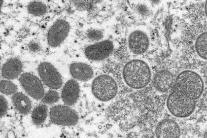 ARCHIVO - En esta imagen de 2003 tomada por un microscopio de electrones y publicada por los Centros de Control y Prevención de enfermedades, viriones maduros de viruela del mono con forma ovalada, y viriones inmaduros con forma redonda, obtenidos de una muestra de piel humana asociada a un brote de 2003 entre perritos de las praderas. (Cynthia S. Goldsmith, Russell Regner/CDC via AP)