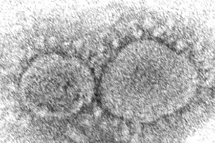 ARCHIVO - Esta imagen de microscopio de 2020 proporcionada por los Centros para el Control y la Prevención de Enfermedades de Estados Unidos muestra partículas del virus SARS-CoV-2, que causan el COVID-19. (Hannah A. Bullock, Azaibi Tamin/CDC via AP, Archivo)