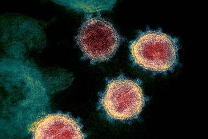 El coronavirus llega hasta el cerebro subiendo por la nariz, según un grupo de científicos alemanes que han analizado tejidos de unos 30 muertos por covid