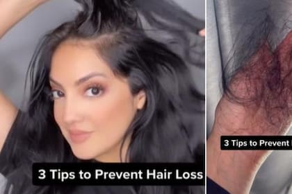 En esta imagen se aprecia a la mujer de esta historia dando consejos para prevenir la caída del cabello