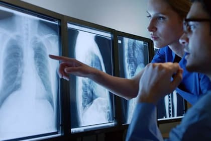 Día Mundial de la Radiología: así fue le descubrimiento que tardó solo tres meses en usarse en gran parte de los hospitales