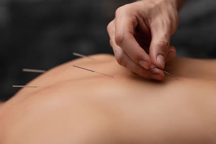 La acupuntura es una de las técnicas que busca el restablecimiento del flujo de energía, con el propósito de facilitar el regreso a la salud