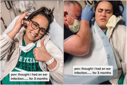 La mujer pensó que tenía una infección en el oído, pero resulta que tuvieron que removerle un curioso objeto